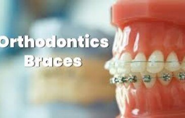 Orthodontic Treatment Near Me: A Step Towards a Perfect Smile