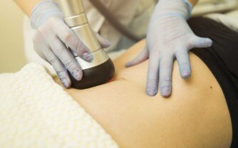 Stomach Hair Removal: Laser vs. Waxing