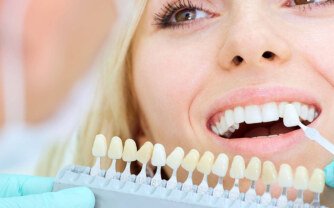 Smile Brighter with Professional Teeth Whitening Treatment