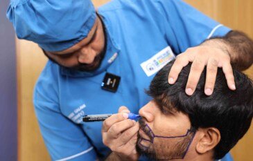 How Pigmentation Treatment Imitates Hair Density