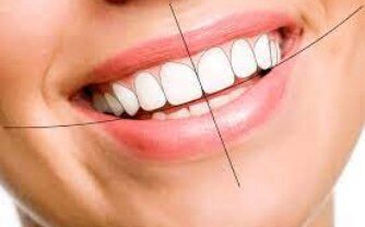 Can DSD Be Combined with Teeth Whitening or Orthodontics?