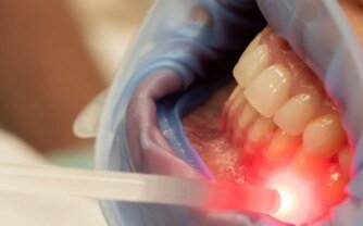 Does diet affect gum pigmentation?