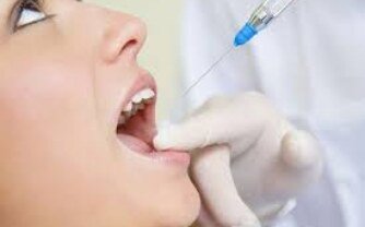 Posterior Root Canal Treatment Options